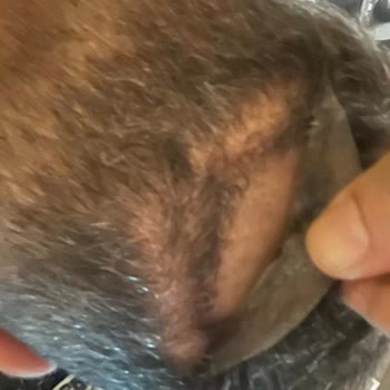 B&B Protez Saç Merkezi Kalitesiz Protez Saç Ve Ölçü Renk Hatası, Saygısız Müşteri Hizmeti