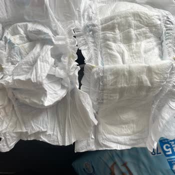 Molfix Ultra Advantage Bebek Bezinde Boş İçerik Sorunu