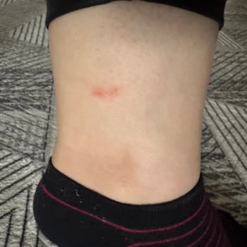 Yaya By Hotiç Fermuar Hatası Ve Tek Kullanımda Topuk Ezilmesi Nedeniyle İade Talebi