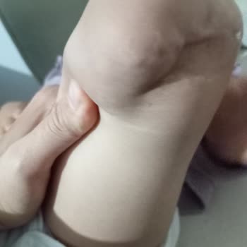 Acil Protez Yardımı Başvurusu Arşive Alındı, Bilgi Ve İletişim Eksikliği