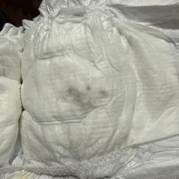 Molfix Bebek Bezinde Yabancı Cisim Görülmesi Korkutucu Güven Sorunu