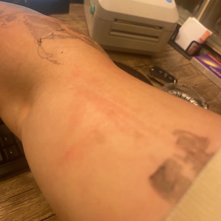 Dövme Ürünü Cilde Geçmedi, Yenisi Talep Ediliyor