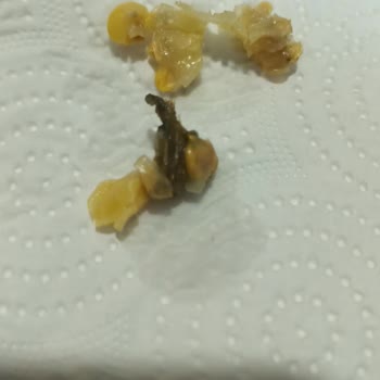 Ta Da Markalı Mısır Ürününde Yabancı Cisim Ve Bakteri Benzeri Oluşumlar Tespit Edildi