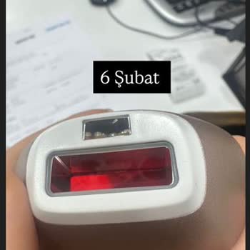 Philips Lumea IPL Cihazının Çatlak Başlığı Ve Uzayan Servis Süreci