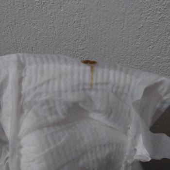 Molfix Bebek Bezinde Sertleşmiş Yağ Şikayeti