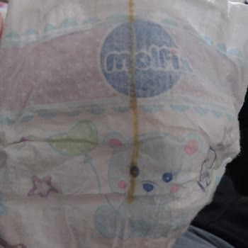 Molfix Bebek Bezinde Sertleşmiş Yağ Şikayeti