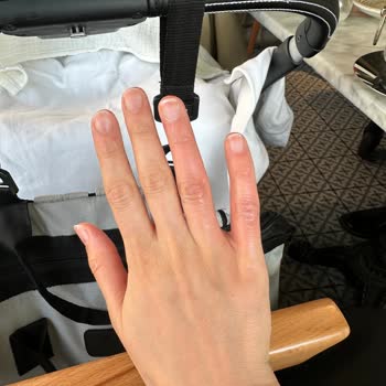 Gebze Karaköy Fırın’da Çaydanlık Yanığı Ve Güvenlik İhmali