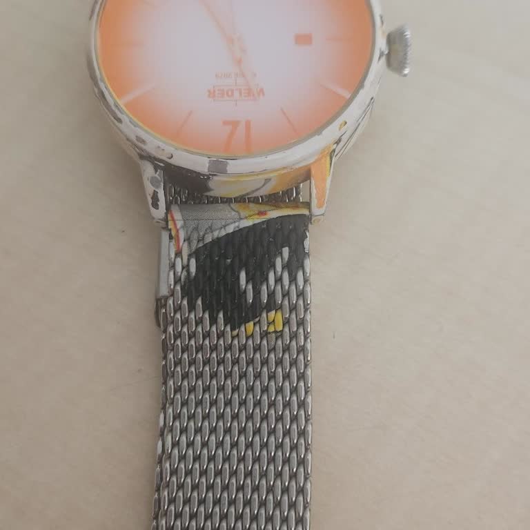 Kordon Alerjisi Ve Renk Solması Nedeniyle Garanti Kapsamında Yeni Kordon Talebi