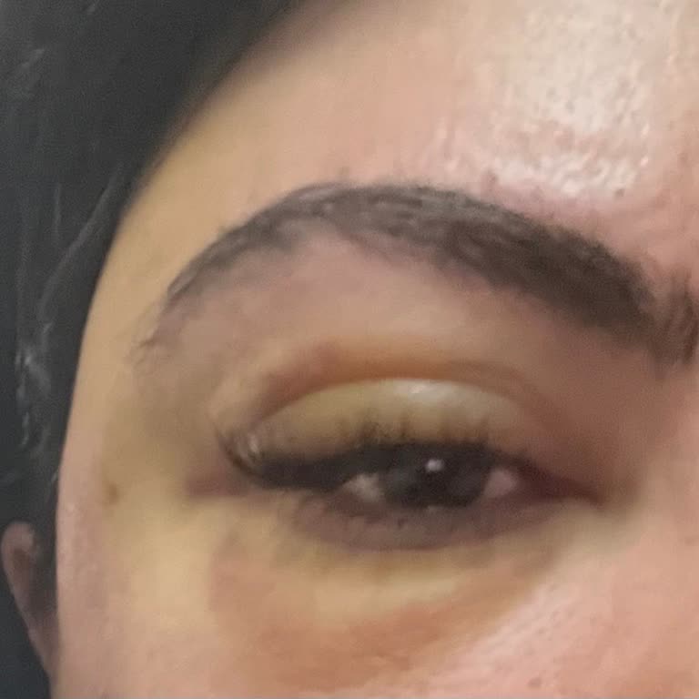 Looken Clinic Hayal Kırıklığı Yaşama