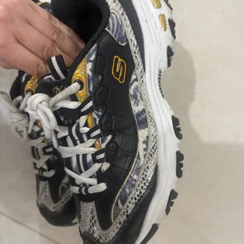 Skechers Kadın Ayakkabısının Ucunun Patlaması Ve Değişim Talebi