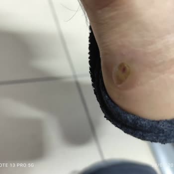 Su Geçirmez Olarak Satılan Botların Su Geçirmesi Ve İade Talebi