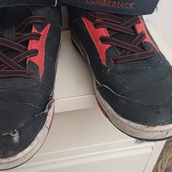 Bot Dikişi 1,5 Ayda Açıldı, Mağaza Kullanıcı Hatası Dedi