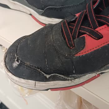 Bot Dikişi 1,5 Ayda Açıldı, Mağaza Kullanıcı Hatası Dedi