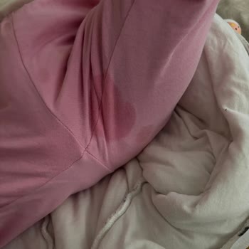 Molfix Maxi Plus Bebek Bezi Sızdırma Ve Emicilik Sorunu