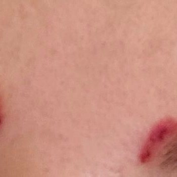 Kaş İşlemi Yanlışlığı Ve Kalitesiz Boya Nedeniyle Ağır Maddi Ve Psikolojik Mağduriyet