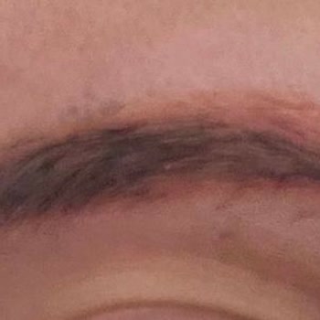 Kaş İşlemi Yanlışlığı Ve Kalitesiz Boya Nedeniyle Ağır Maddi Ve Psikolojik Mağduriyet