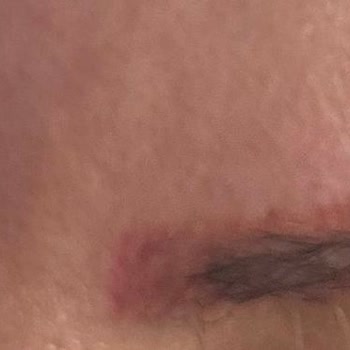 Kaş İşlemi Yanlışlığı Ve Kalitesiz Boya Nedeniyle Ağır Maddi Ve Psikolojik Mağduriyet