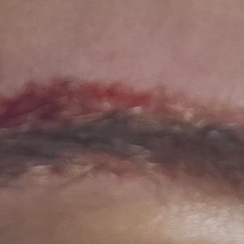 Kaş İşlemi Yanlışlığı Ve Kalitesiz Boya Nedeniyle Ağır Maddi Ve Psikolojik Mağduriyet