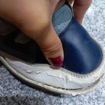 Ayakkabının 1 Ayda Açılması Ve Müşteri Hizmetlerinden Cevap Gelmemesi