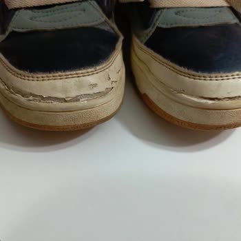 Ayakkabının 1 Ayda Açılması Ve Müşteri Hizmetlerinden Cevap Gelmemesi