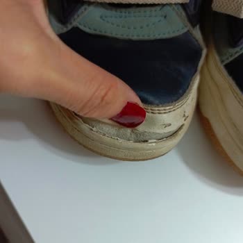 Ayakkabının 1 Ayda Açılması Ve Müşteri Hizmetlerinden Cevap Gelmemesi