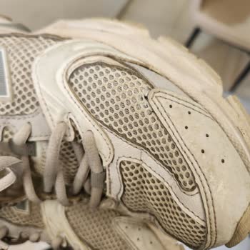 Ayakkabının Kısa Sürede Deformasyonu Ve Garanti Reddi