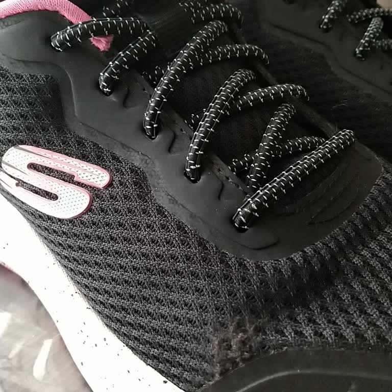 Skechers Ayakkabım 5 Ayda Yırtıldı, Mağaza Kullanıcı Hatası Dedi