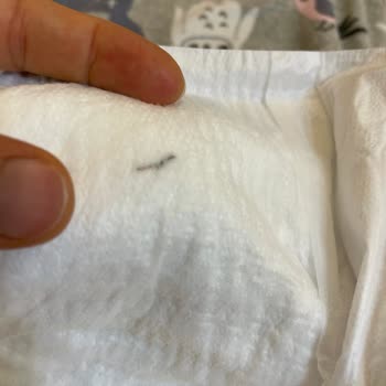 Molfix Bebek Bezinde Metal Parça Görmek Güveni Sarstı
