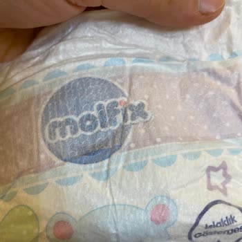 Molfix Bebek Bezinde Metal Parça Görmek Güveni Sarstı