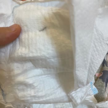 Molfix Bebek Bezinde Metal Parça Görmek Güveni Sarstı