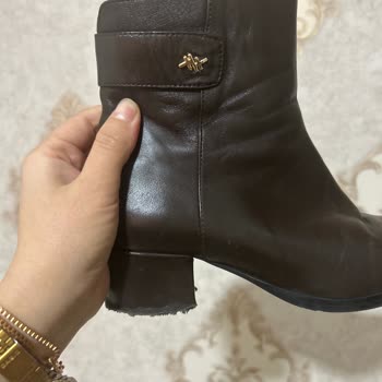 Topuk Kapağı Çıktı Müşteri Hizmeti Çözüm Sunmadı