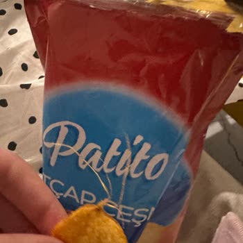 Patito Cipsinde Yabancı Madde Bulunması Ve Mağaza İhmali