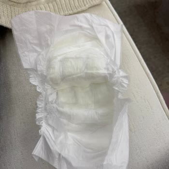 Sleepy Yenidoğan Bezlerinde Üretim Hatası Ve İade Talebi