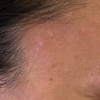 Dermatolog Önerili Yüz Yıkama Jeli Cildimi Mahvetti