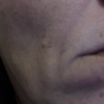 Dermatolog Önerili Yüz Yıkama Jeli Cildimi Mahvetti