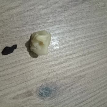 Mantı Ürünün İçindeki Sert Siyah Cisim Sağlık Riski