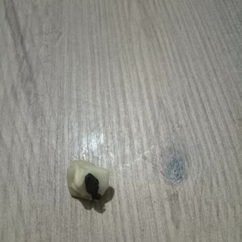 Mantı Ürünün İçindeki Sert Siyah Cisim Sağlık Riski