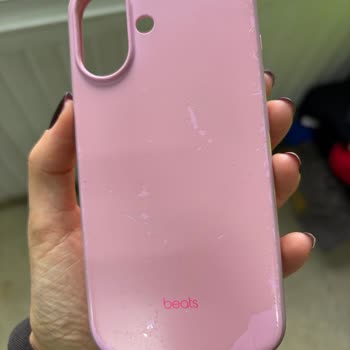 Beats Telefon Kılıfındaki Soyulma Ve Renk Atma Sorunu Ve Müşteri Hizmetleri İhmali