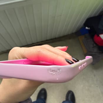 Beats Telefon Kılıfındaki Soyulma Ve Renk Atma Sorunu Ve Müşteri Hizmetleri İhmali