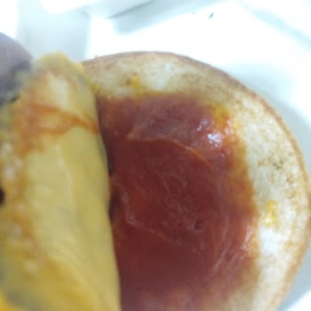 Alerji Uyarısı Görmezden Gelindi, Soğuk Ve Dökülmüş Ürünler İçin İade Talebi