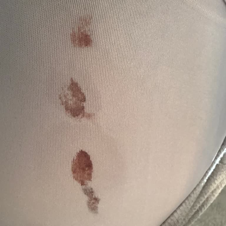 İğne Uygulamasında Dikkatsiz Hata, Kanama Ve Saygısız Tutum