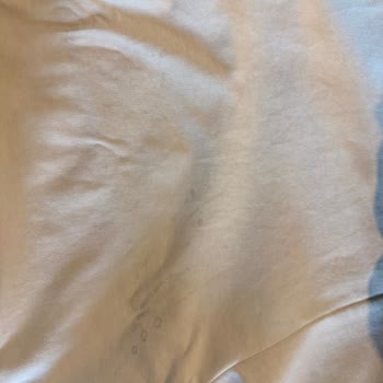 İlk Yıkamada Leke Çıkan Eşofmana İade Reddi Ve İletişim Sorunu