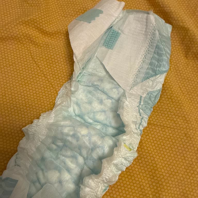 Trendyol’da Kalitesiz Prima Bebek Bezi, Değişim Reddedildi, İade İstiyorum