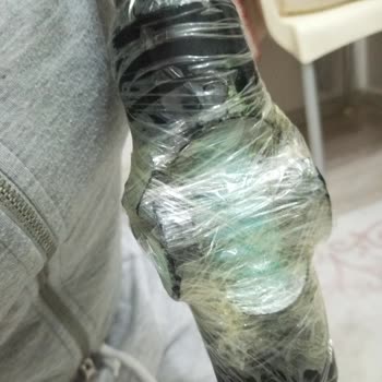 Garanti Kapsamında Kırılan Boru Bağlantısı Nedeniyle Fakir Bolt Aqua Süpürge Kullanılamaz