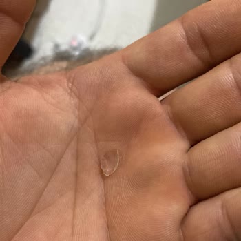 Eskişehir Erenköy Ala Fırın’da Satılan Baklava İçinde Cam Parçası Tespit Edildi
