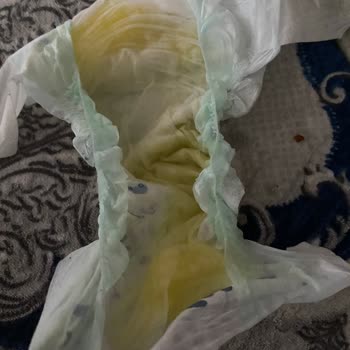 Sızdıran Ve Sıvıyı Emmeyen Bebek Bezi