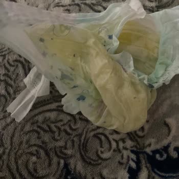 Sızdıran Ve Sıvıyı Emmeyen Bebek Bezi