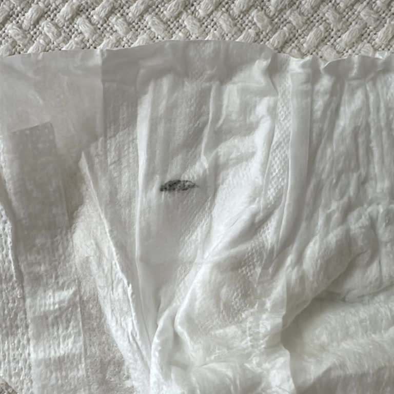 Molfix Bebek Bezinde Siyah Yabancı Madde Endişe Yaratıyor