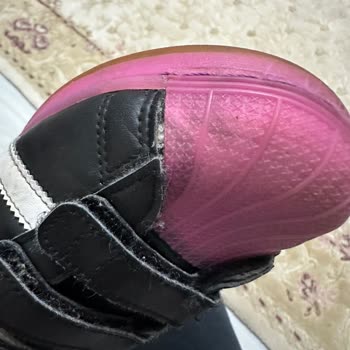 Superstar Ayakkabım 3 Ayda Açıldı, Garanti Reddi Ve Ücretsiz Değişim Talebi