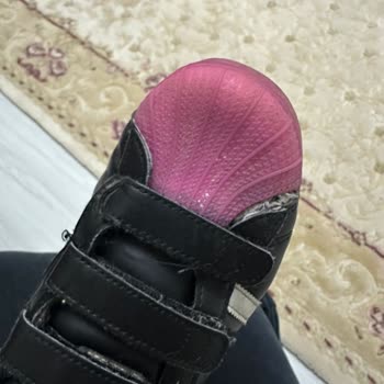 Superstar Ayakkabım 3 Ayda Açıldı, Garanti Reddi Ve Ücretsiz Değişim Talebi